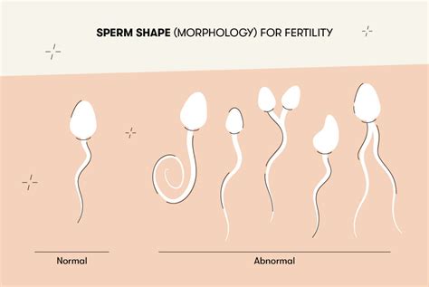 How much sperm can impregnate a girl?