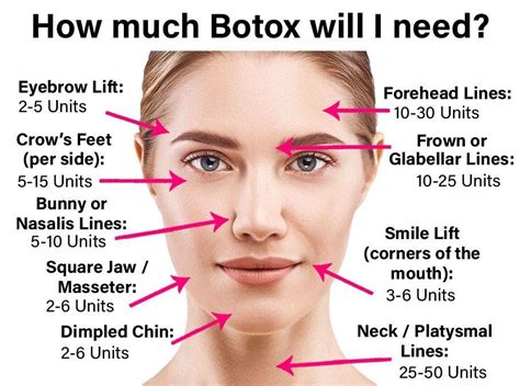 How much toxin is in Botox?