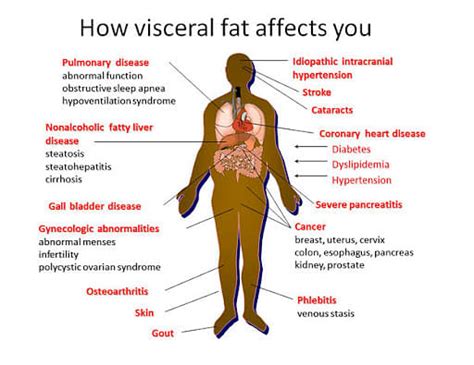 How much visceral fat is bad?