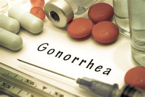 How obvious is gonorrhea?