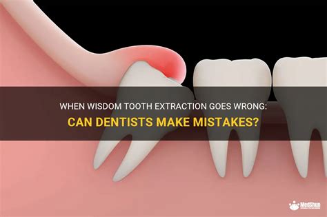 How often do dentists make mistakes?