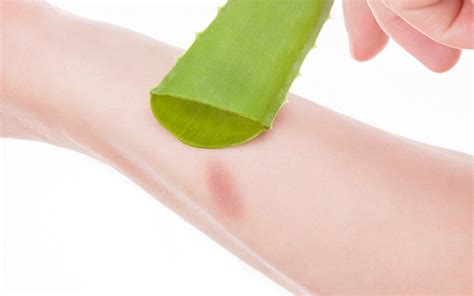 How often should you apply aloe after burn?