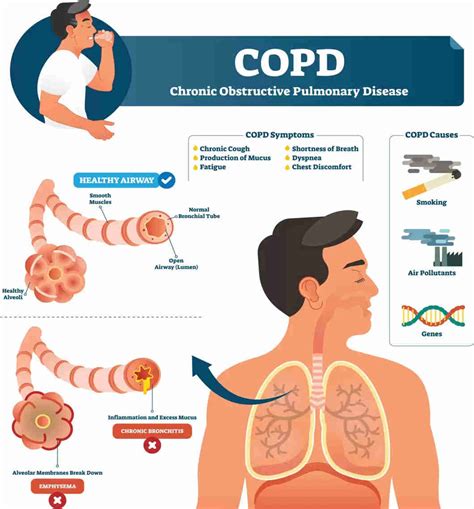 How old is the average COPD patient?