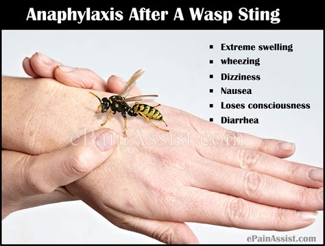 How painful is a normal wasp sting?