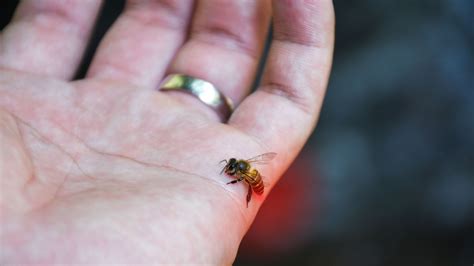How painful is bee sting?