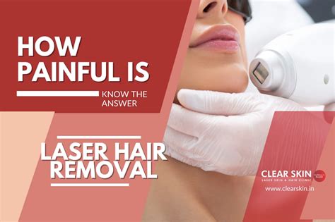 How painful is laser hair removal?