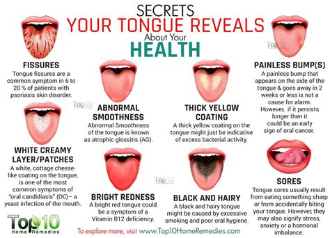 How rare is a short tongue?