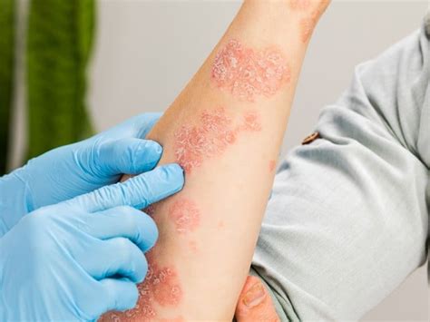 How serious is a skin rash?