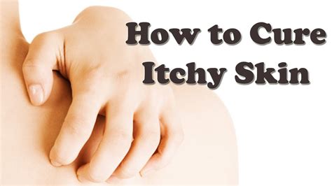 How serious is itchy skin?