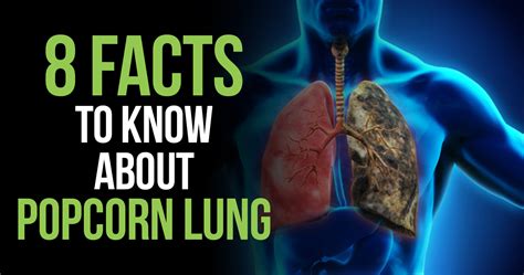 How serious is popcorn lung?