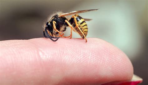 How severe is a wasp sting?