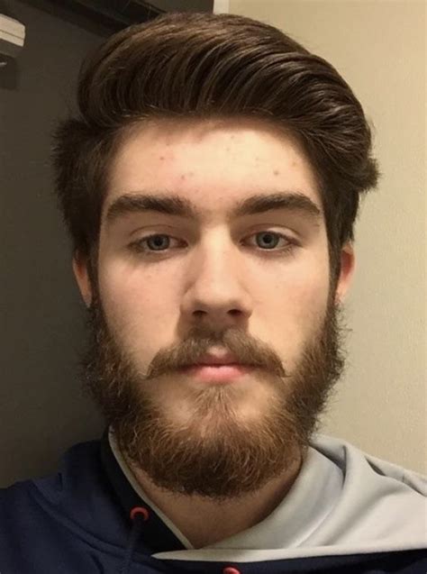 How should a 17 year olds beard look?