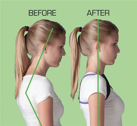 How should neck posture look?