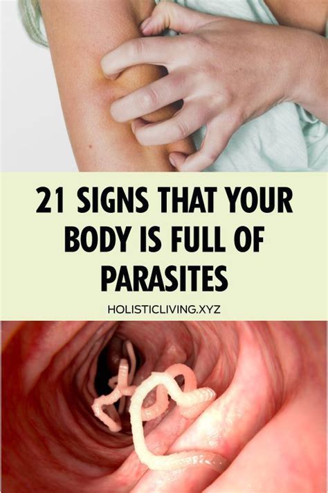 How sick can parasites make you?