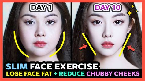 How to get chubby cheeks in 3 days?