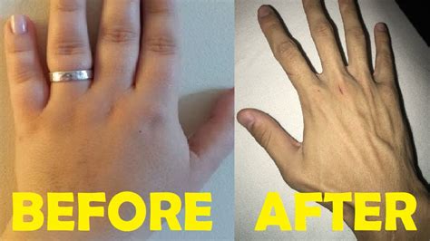 How to get chubby hands?