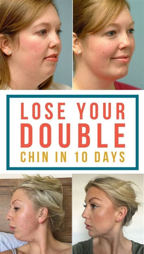 How to get rid of double chin?