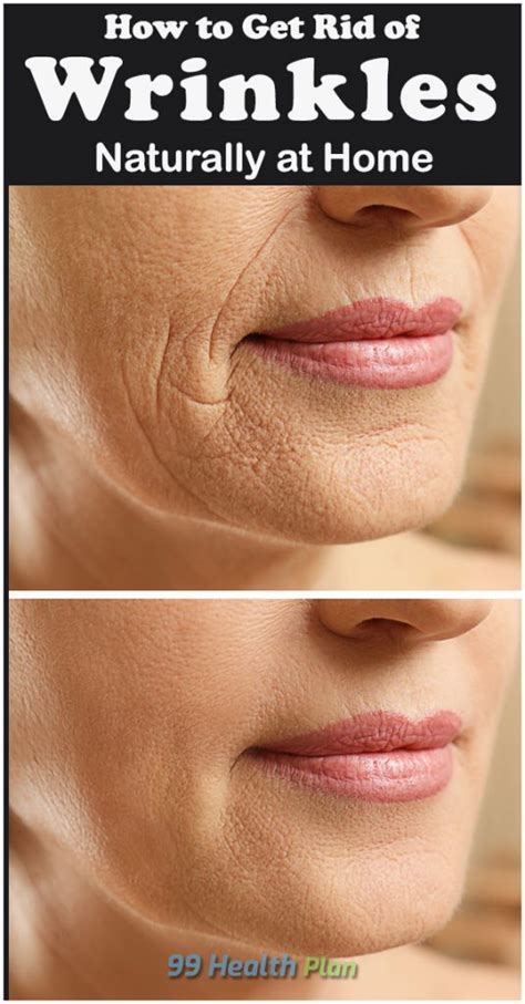 How to get rid of facial wrinkles?