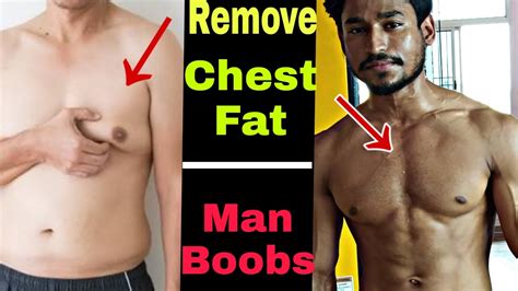 How to hide chest fat?