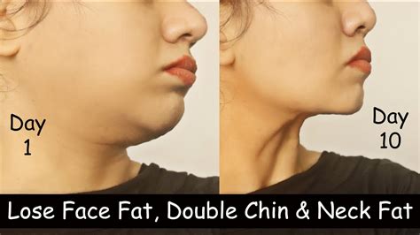 How to lose a double chin?