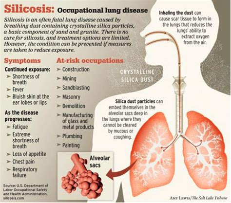 How to prevent Pneumonoultramicroscopicsilicovolcanoconiosis?