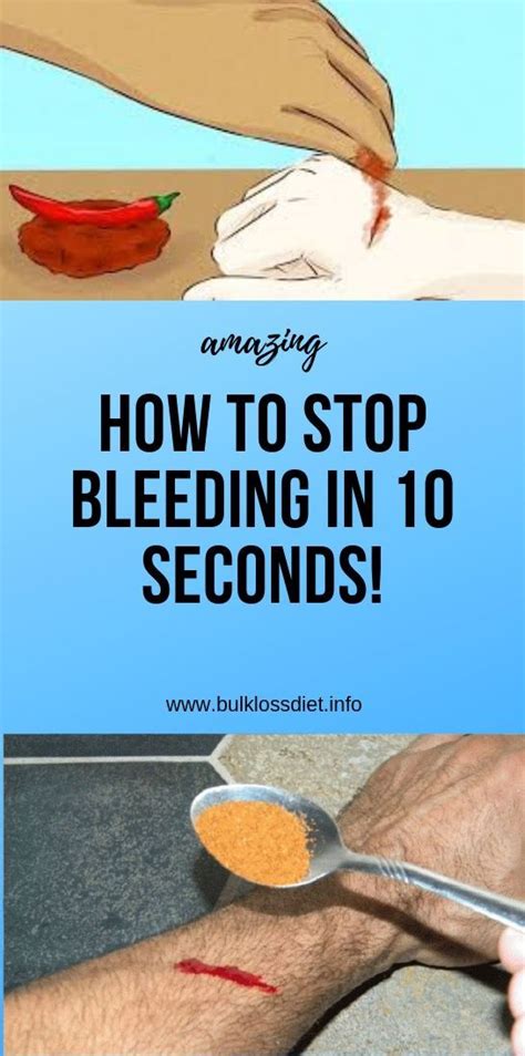 How to stop bleeding?