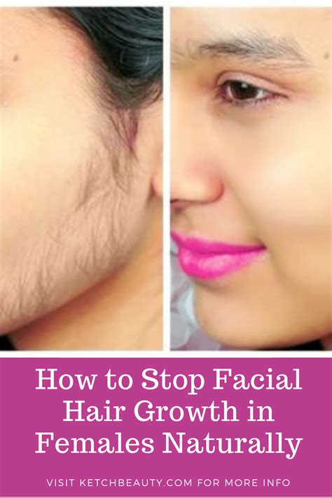 How to stop facial hair growth in females naturally permanently?