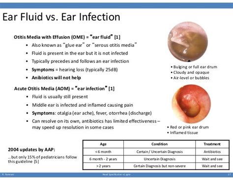 How to tell difference between fluid in ear and ear infection?