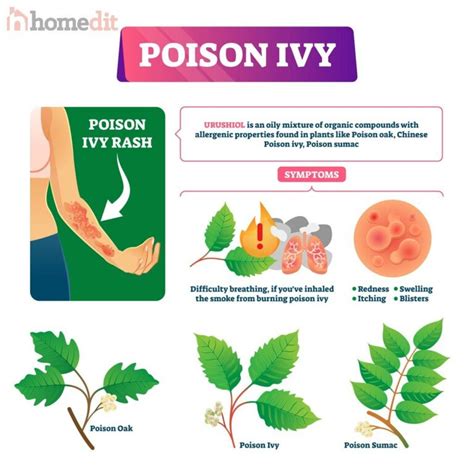 How to tell the difference between poison ivy and poison oak rash?