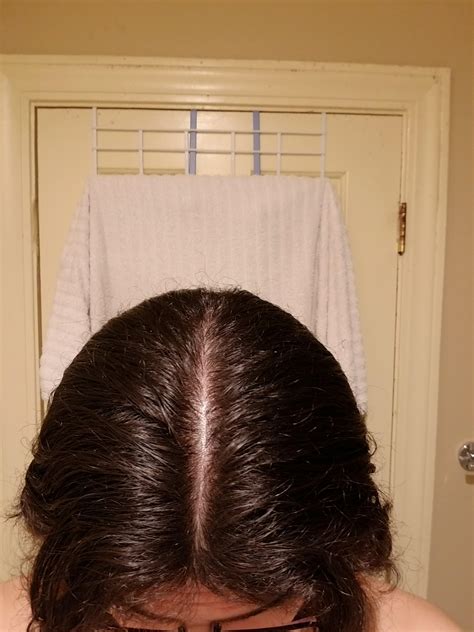 How wide should a hair part be?