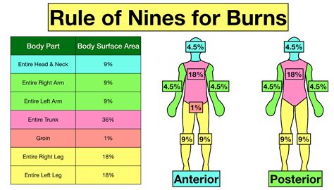 How would you calculate a burn based on the rule of nines chart?