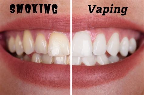Is 0 nicotine vape bad for teeth?