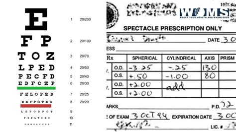 Is 0.5 eye prescription bad?