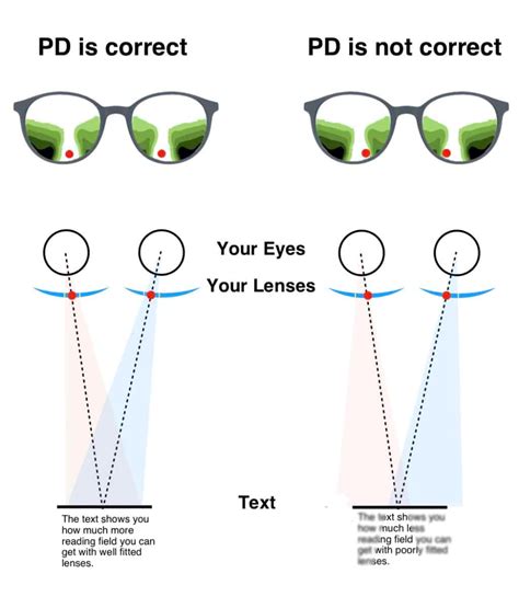 Is 1.50 vision bad?