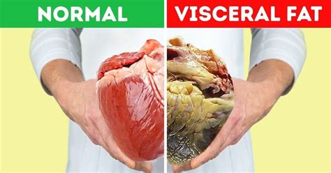 Is 10% visceral fat good?