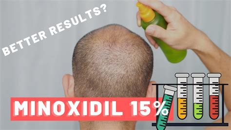 Is 10 minoxidil safe?
