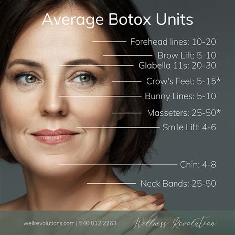 Is 10 units of Botox enough for 11 lines?