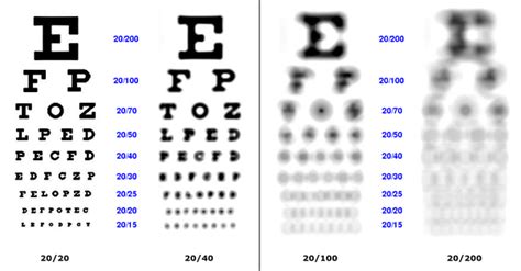Is 1000 eye grade bad?