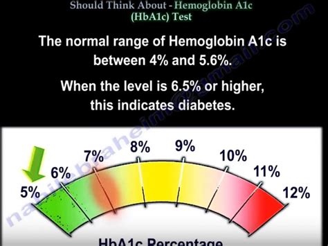 Is 130 a high ALT level?