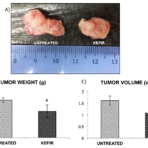 Is 2.7 cm a large tumor?