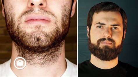 Is 23 too late to grow a beard?