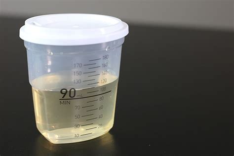 Is 300ml of urine a lot?