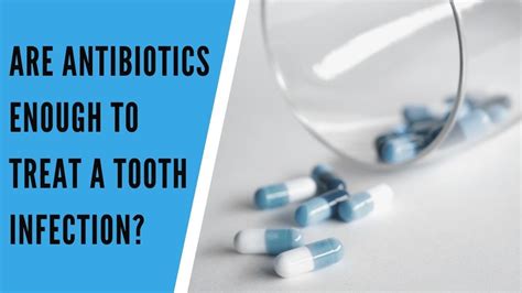 Is 5 days of antibiotics enough for tooth infection?