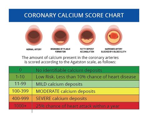 Is 500 a high calcium score?