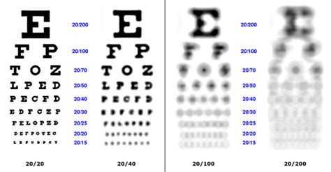 Is 500 eye grade bad?