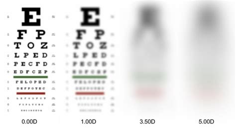Is 500 vision bad?