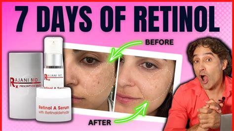 Is 70 too old to use retinol?