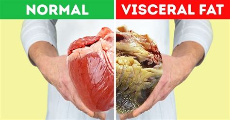 Is 9 visceral fat good?