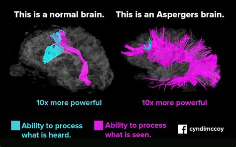 Is Asperger's neurodivergent?