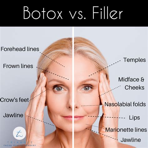 Is Botox better than hyaluronic acid?